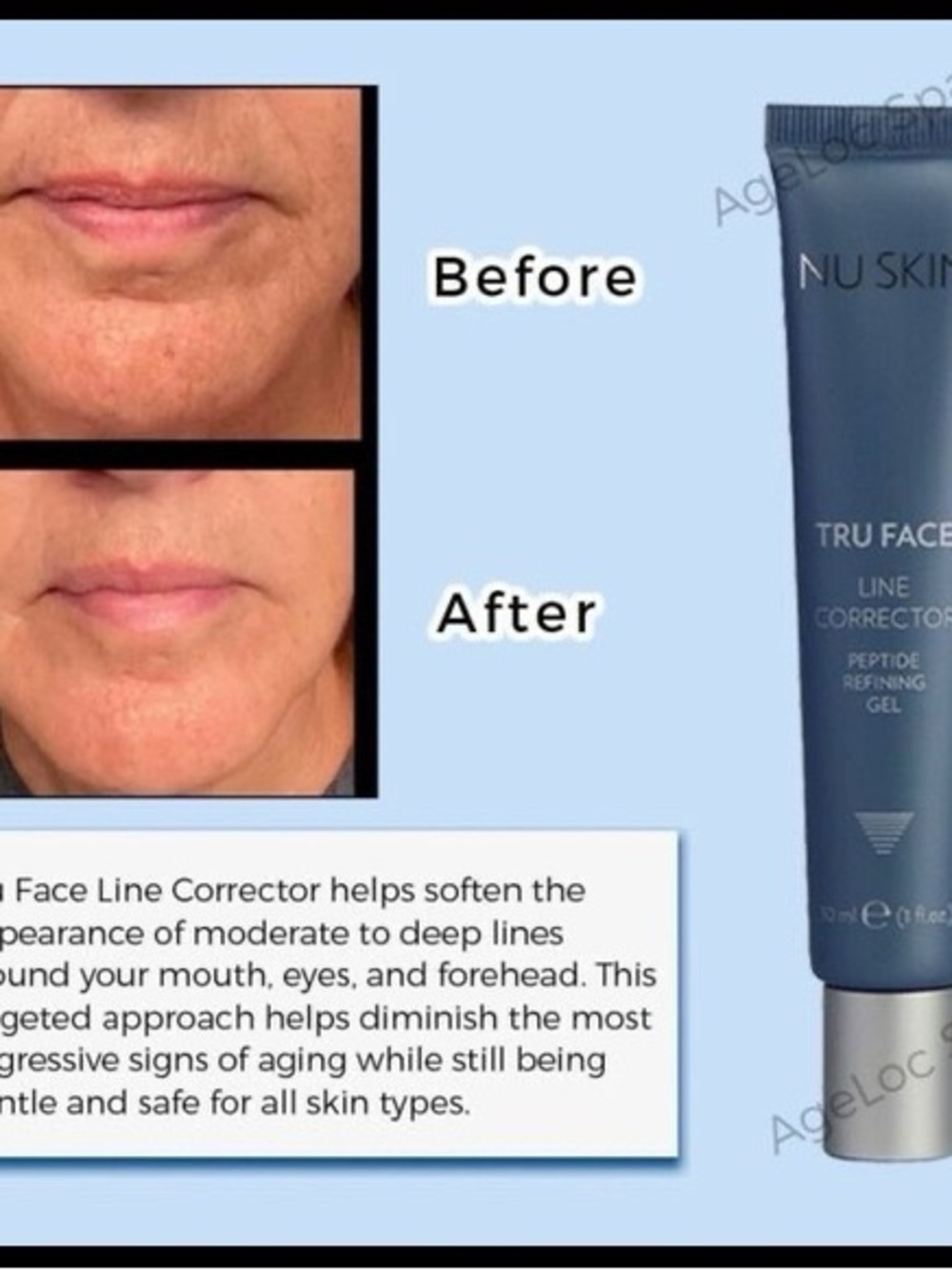 BNIP- GloPRO Microneedling Tool and Tru Face Line Corrector Kit - Picture 11 of 16
